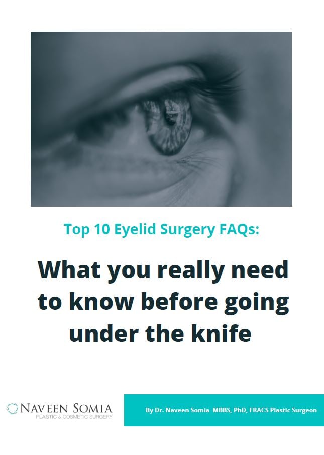 Ebook-Top10-Eyelid-Surgery-FAQs
