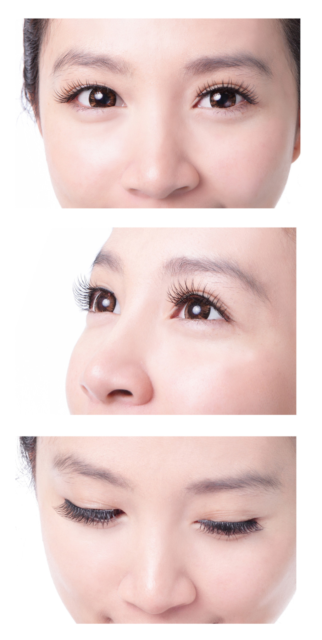 double eyelid surgery side effects