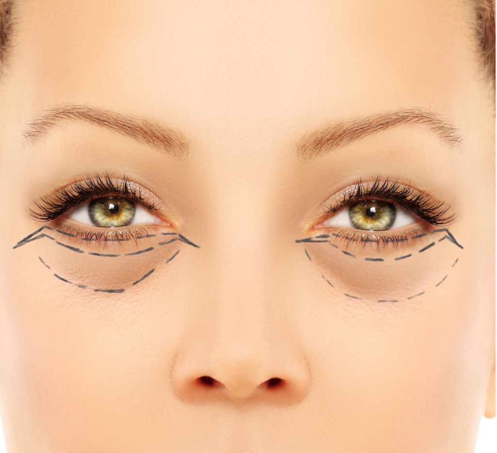 Lower Eyelid Surgery 