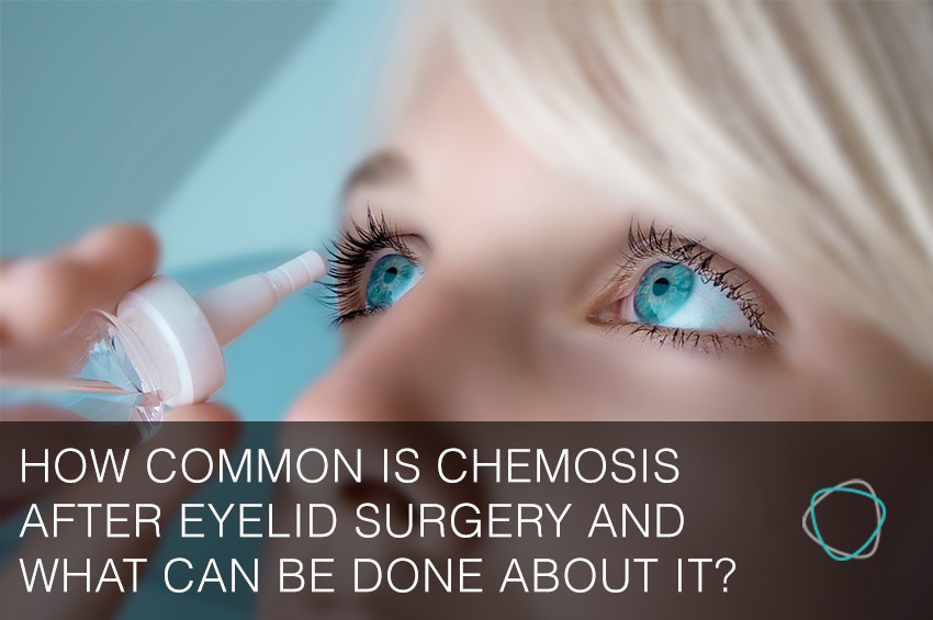 How to diagnose and treat Chemosis after Eyelid Surgery