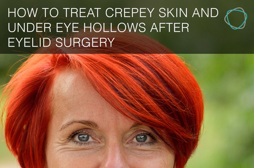 How to treat crepey skin and under eye hollows after eyelid surgery