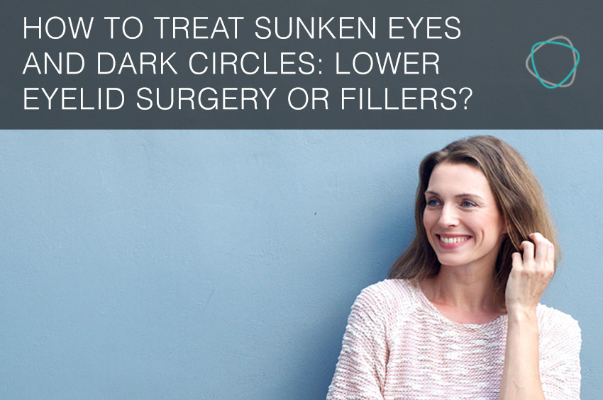 How to treat sunken eyes and dark circles Eyelid Surgery or Fillers?