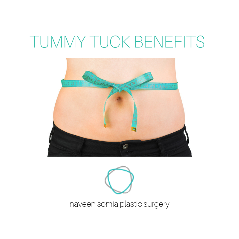 4 Key Benefits for Tummy Tuck